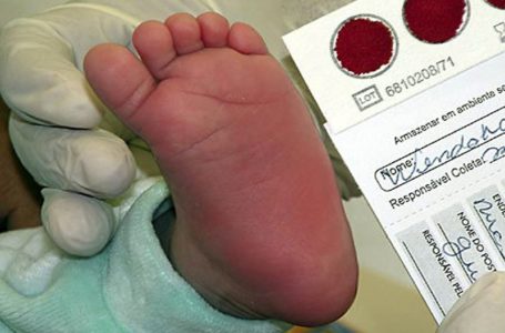 Diagnosticada pelo teste do pezinho, especialistas alertam para a conscientização da anemia falciforme