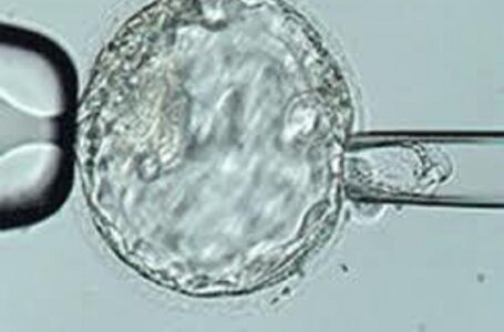 Novidade na Reprodução Assistida: PGT-P, teste genético do embrião para distúrbios poligênicos