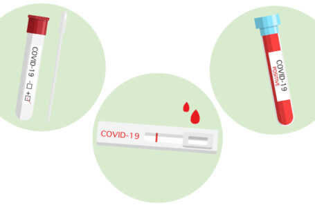 Hospital Santa Cruz passa a oferecer três tipos de testes para diagnóstico da COVID-19
