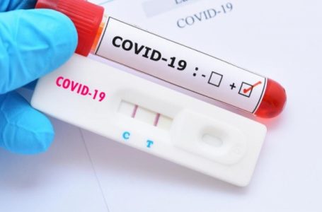 MSF denuncia abuso em preço de teste para COVID-19