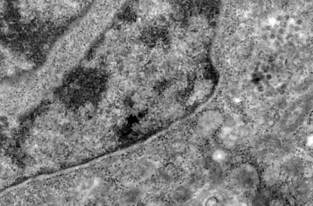 Casos de covid-19 no mundo passam de 250 milhões