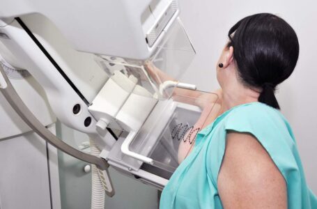 Menos de 35% das brasileiras acima de 45 anos fizeram mamografia este ano, aponta levantamento da FEMAMA